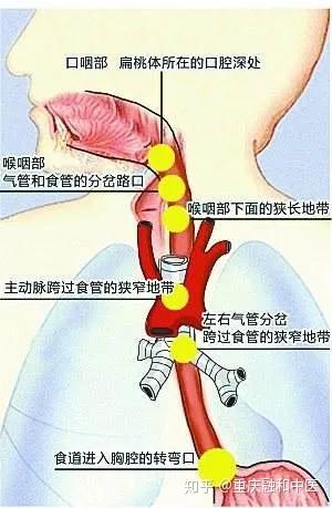 女子吃火鍋被魚刺卡喉致食管破裂,女子吃火鍋遭遇魚刺卡喉致食管破裂的狀況分析解析說(shuō)明,全面數(shù)據(jù)執(zhí)行方案_Executive99.31.41