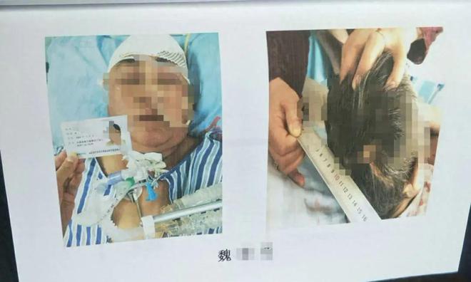 女子目睹母親被撞飛 受驚嚇身亡